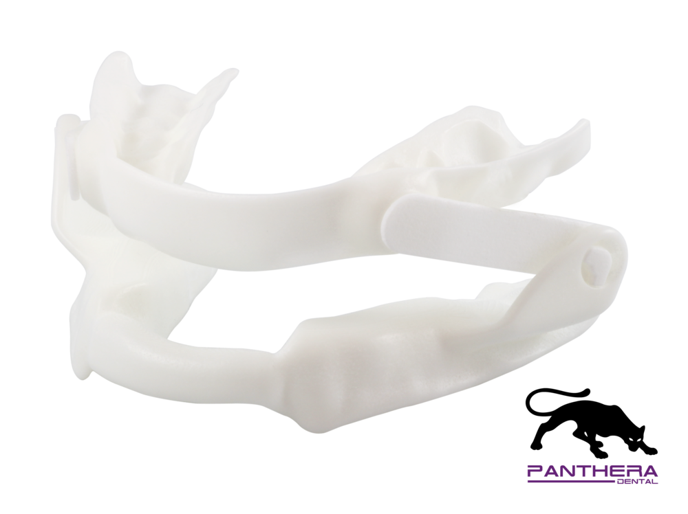 Oral Appliance Therapy Noninvasive CPAP Alternative Toronto Dental Snoring Treatment